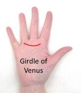 Girdle of Venus
